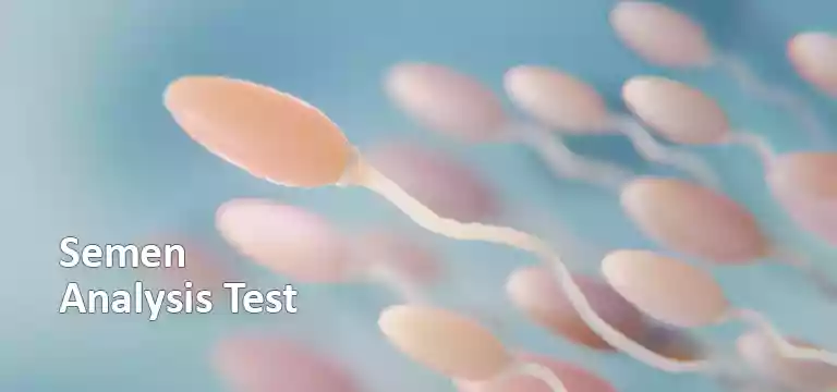 Semen Analysis Test: A Complete Guide Regarding Test Preparation, Procedure, Uses & Cost